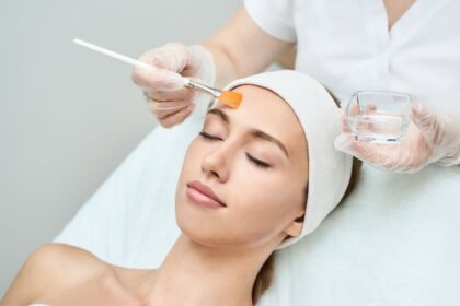 4 Essential Aftercare Tips for Chemical Peels